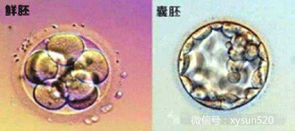 广州代怀医院供卵,要不要养囊？广州试管囊胚移植的5个理由_卵巢早衰了23岁，